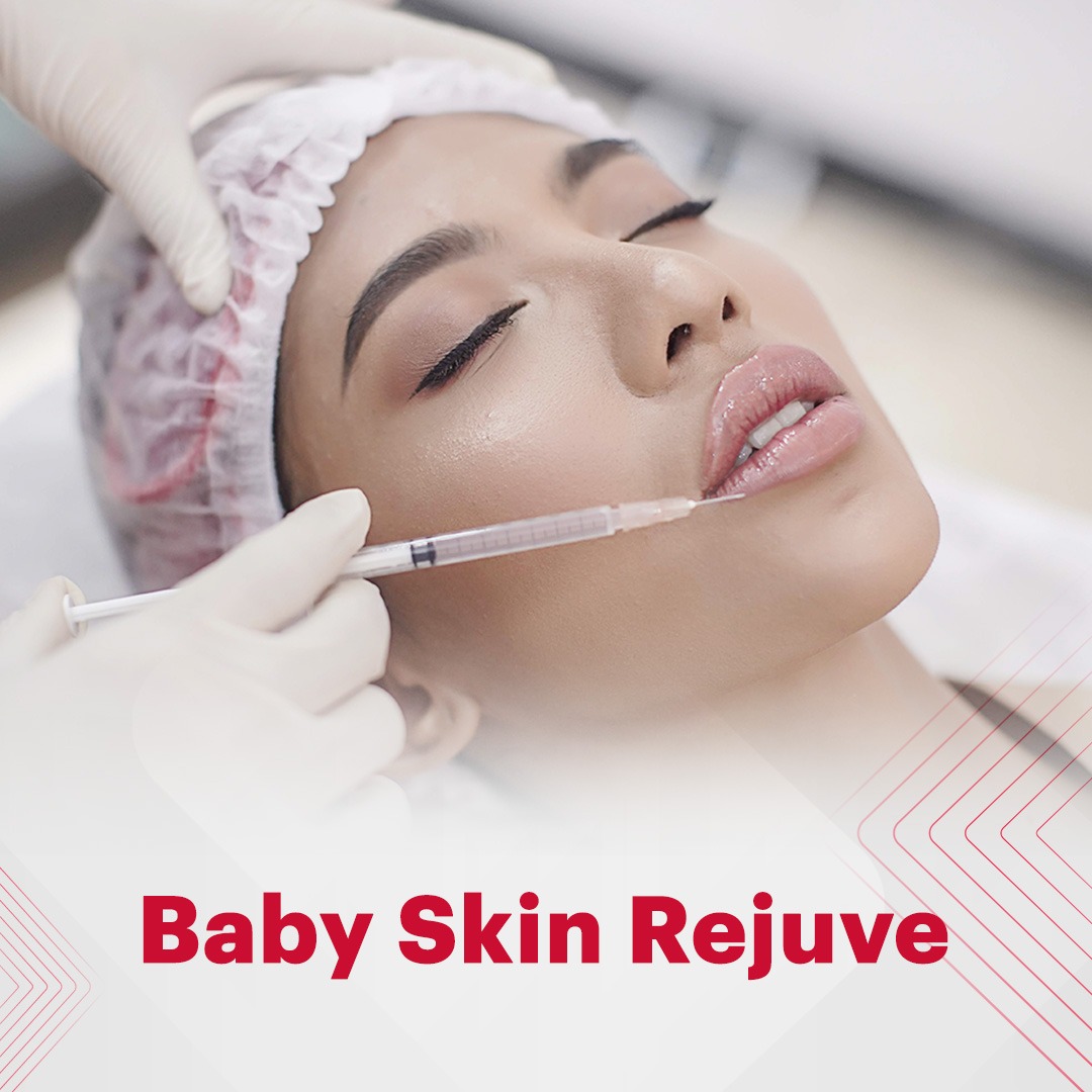 Gloskin Baby Skin Rejuve GLOSKIN AESTHETIC CLINIC Bridestory
