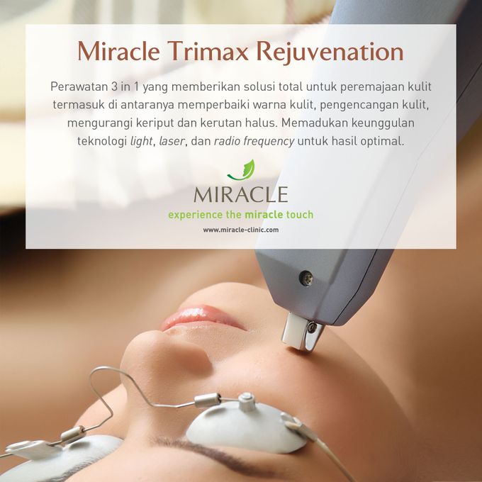 Perawatan Nina Zatulini di Miracle Jakarta (Prewedding) by Miracle Aesthetic Clinic - 002 Perawatan Nina Zatulini di Miracle Jakarta (Prewedding) by Miracle Aesthetic Clinic - 002